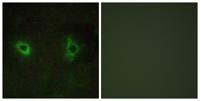 COL4A3 Polyclonal Antibody