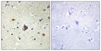 COL4A3 Polyclonal Antibody