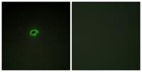 COL4A4 Polyclonal Antibody