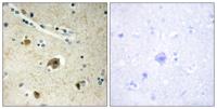 COL4A4 Polyclonal Antibody