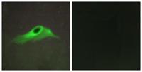 COL4A5 Polyclonal Antibody