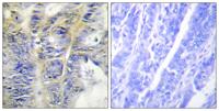 COL4A5 Polyclonal Antibody