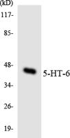 COL4A5 Polyclonal Antibody