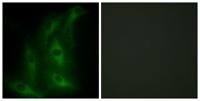 COL4A6 Polyclonal Antibody