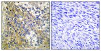 COL4A6 Polyclonal Antibody