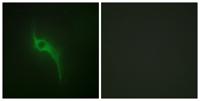 COL5A1 Polyclonal Antibody