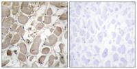 COL5A1 Polyclonal Antibody