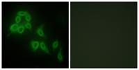 COL5A2 Polyclonal Antibody