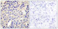 COL5A2 Polyclonal Antibody