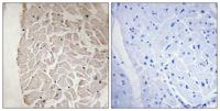 COL6A1 Polyclonal Antibody