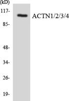 COL6A1 Polyclonal Antibody