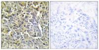 COL6A2 Polyclonal Antibody
