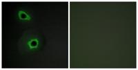 COL7A1 Polyclonal Antibody