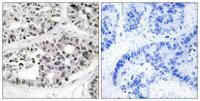 COL7A1 Polyclonal Antibody