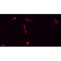 Collagen I Polyclonal Antibody