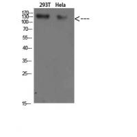 Collagen I Polyclonal Antibody