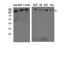 Collagen IV  Polyclonal Antibody