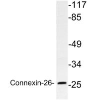 Connexin-26 Polyclonal Antibody