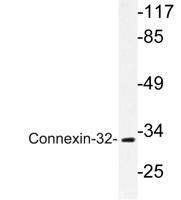 Connexin-32 Polyclonal Antibody