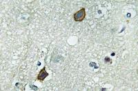 Connexin-45 Polyclonal Antibody