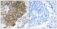 Connexin 46 Polyclonal Antibody