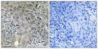 COP ζ1 Polyclonal Antibody