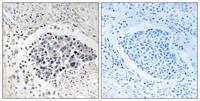 Copine 8 Polyclonal Antibody