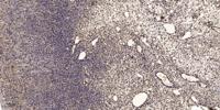 Coronin 1A Polyclonal Antibody