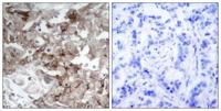 Cortactin Polyclonal Antibody