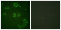 COT Polyclonal Antibody