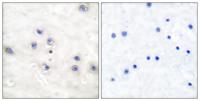 COT Polyclonal Antibody