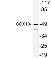 COX10 Polyclonal Antibody