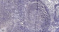 COX11 Polyclonal Antibody