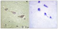 COX15 Polyclonal Antibody