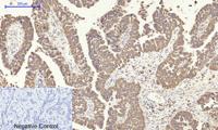 COX-2 Polyclonal Antibody