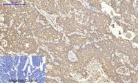 COX-2 Polyclonal Antibody