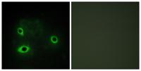 COX4I2 Polyclonal Antibody