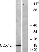 COX4I2 Polyclonal Antibody