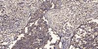 COX4I2 Polyclonal Antibody