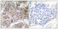 COX7a2/3 Polyclonal Antibody