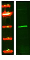 CP4FN Polyclonal Antibody
