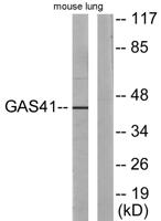 GAS41 Polyclonal Antibody