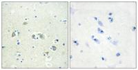 Gas6 Polyclonal Antibody