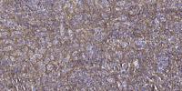 Gas8 Polyclonal Antibody
