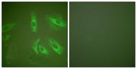 Gastrin Polyclonal Antibody