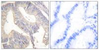 Gastrin Polyclonal Antibody