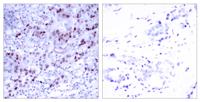 GATA-1 Polyclonal Antibody