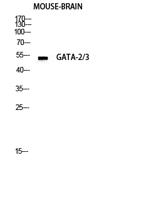 GATA-2/3 Polyclonal Antibody