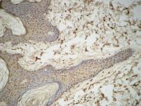 GATA-2/3 Polyclonal Antibody