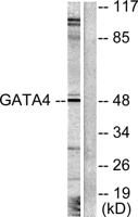 GATA-4 Polyclonal Antibody